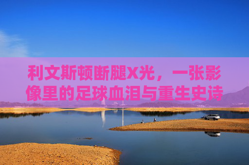 利文斯顿断腿X光,一张影像里的足球血泪与重生史诗,利文斯顿断腿X光,足球血泪与重生史诗